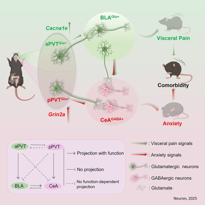 How paraventricular thalamus mediates visceral pain and anxiety-like behaviors