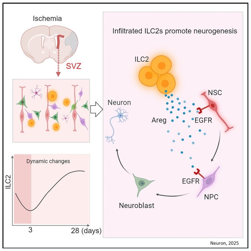 The mechanisms of neurorepair after stroke!