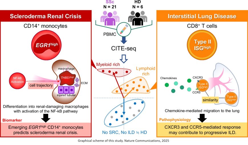 Single-cell analysis reveals immune cell abnormalities underlying the clinical heterogeneity of patients with systemic sclerosis