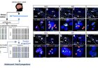 Proliferating neural progenitors identified in the adult human hippocampus