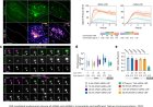 Challenges to lipid nanoparticle mediated delivery of RNA to the cytosol