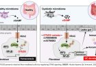 A deubiquitinase prevents ulcerative colitis by inhibiting microbiota-mediated STING activation