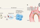 Gut bacteria derived molecule promotes atherosclerosis