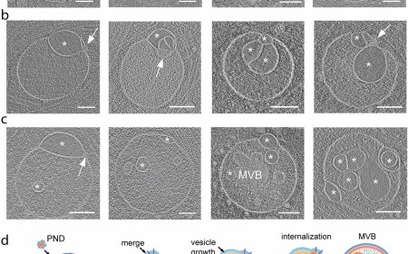 Unknown organelle inside our cells discovered!