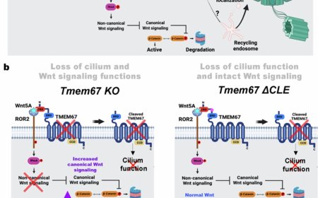 A molecular mechanism affecting ciliopathies uncovered!