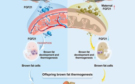 How maternal obesity impairs fetal brown adipogenesis