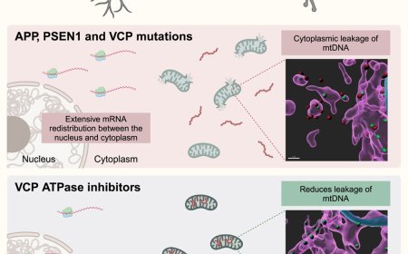 Mislocalization of nucleic acids is a convergent and targetable mechanism in Alzheimer’s disease and frontotemporal dementia