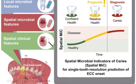 AI system for single-tooth prediction of early childhood caries detection