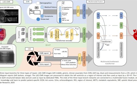 Multimodal AI to forecast arrhythmic death in hypertrophic cardiomyopathy