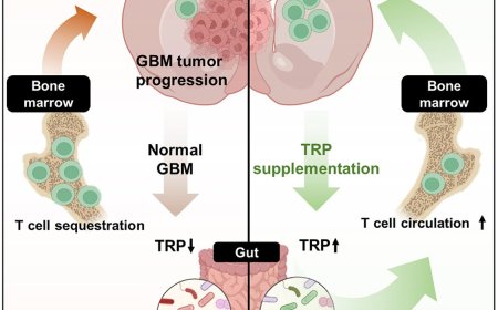 Gut microbiota dysbiosis induced by brain tumors modulates the efficacy of immunotherapy