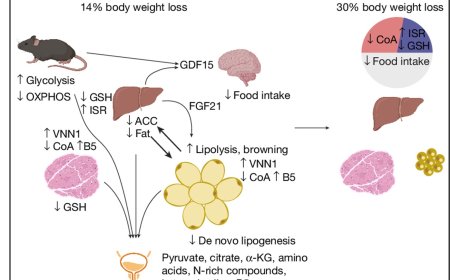 Reduction in amino acid cysteine triggers weight loss