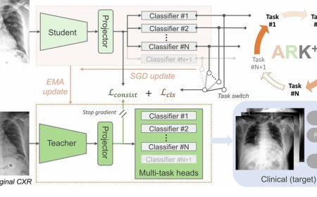 An open AI model to interpret chest X-rays