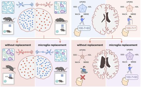 Microglia replacement halts the progression of microgliopathy in mice and humans