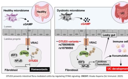 A deubiquitinase prevents ulcerative colitis by inhibiting microbiota-mediated STING activation