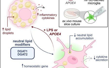 Triglyceride metabolism controls Alzheimer’s associated microglial phenotypes and inflammation