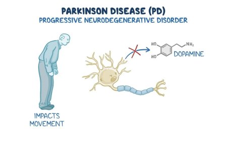 PARKINSON’S DISEASE