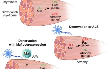 Mechanism of fast myofiber loss in neuromuscular disease