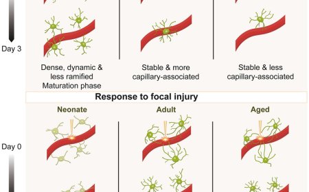 Microglial dynamics across the lifespan under normal and injury conditions