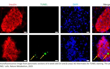 LONP1 regulation of mitochondrial protein folding provides insight into beta cell failure in type 2 diabetes