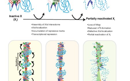 New gene therapy for X-linked Rett syndrome in girls