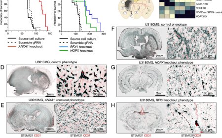 Key genes controlling brain tumor spread identified