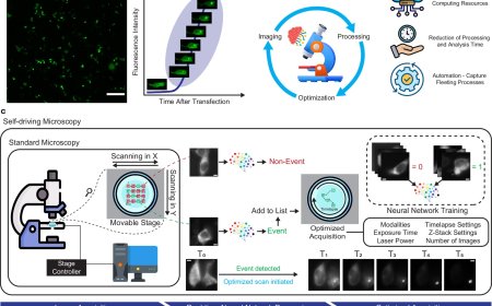 Self-driving microscopy detects the onset of protein aggregation and enables intelligent Brillouin imaging