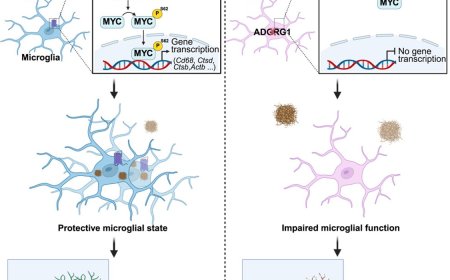 How microglia engulf and break down amyloid beta