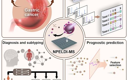 Label-free histopathology in gastric cancer diagnosis