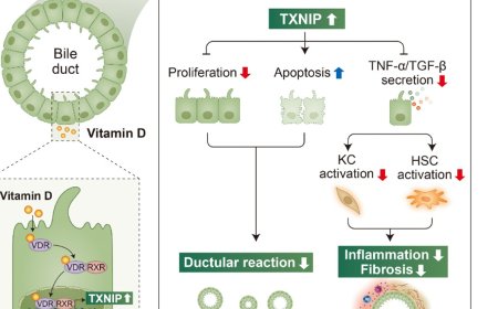 Vitamin D reduces liver damage