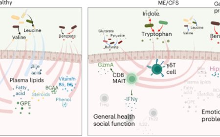 Gut microbiome may predict “invisible” chronic fatigue syndrome and long COVID