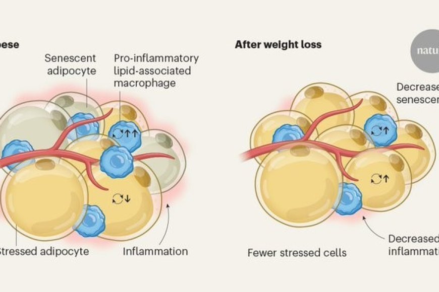 View of Weight loss alters adipose tissue beyond just reducing fat - Sciencemission