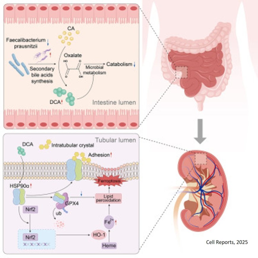 Gut microbiota-bile acid crosstalk contributes to calcium oxalate nephropathy through Hsp90α-mediated ferroptosis