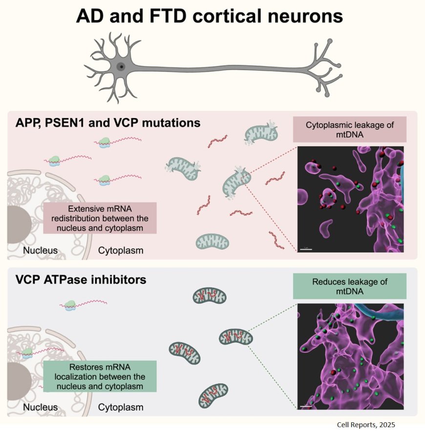 Mislocalization of nucleic acids is a convergent and targetable mechanism in Alzheimer’s disease and frontotemporal dementia