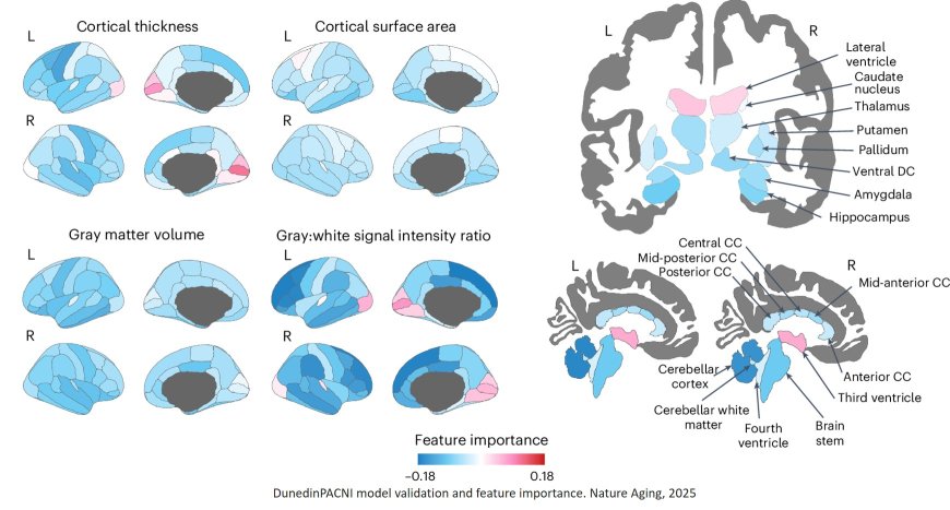 A single brain scan can tell how fast you're aging