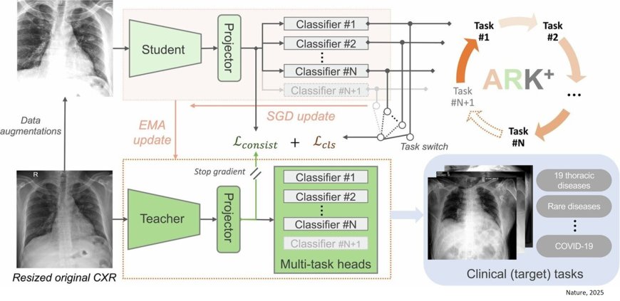 An open AI model to interpret chest X-rays