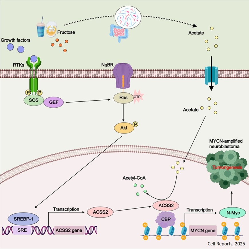 High fructose promotes MYCN-amplified neuroblastoma progression through NgBR-ACSS2- mediated biosynthesis of acetyl-CoA