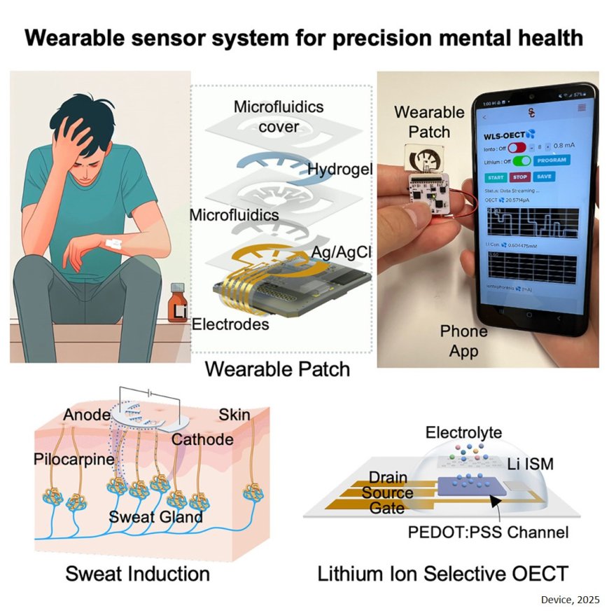 Wearable organic-electrochemical-transistor-based lithium sensor for precision mental health