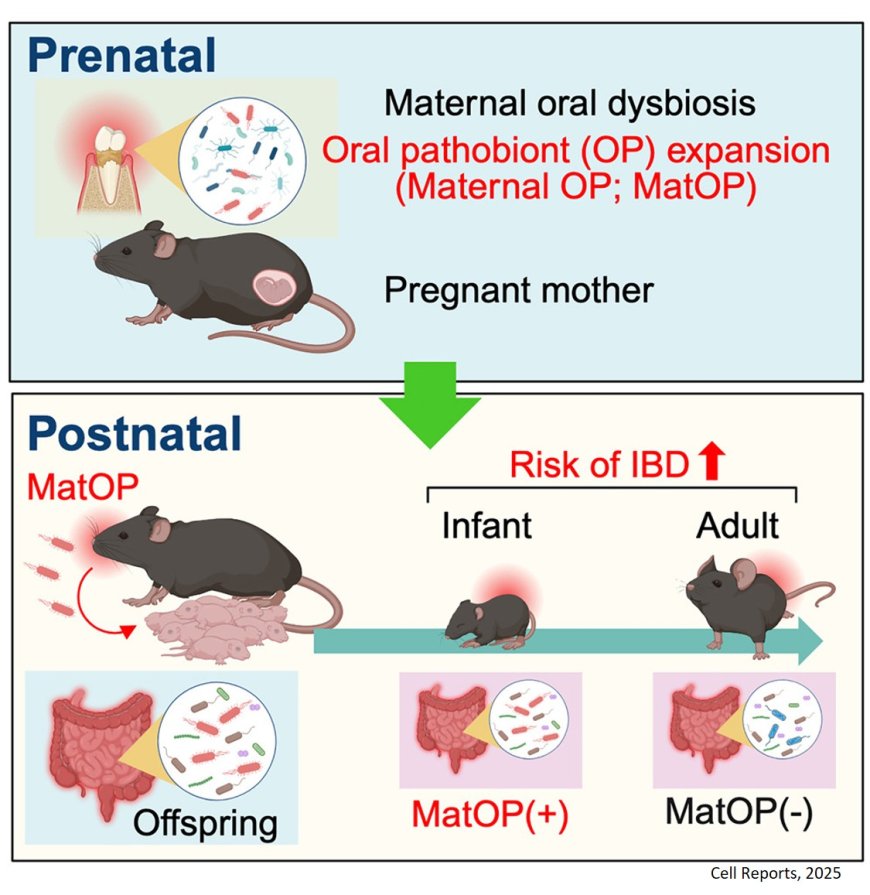 Maternal oral dysbiosis affects infant health!