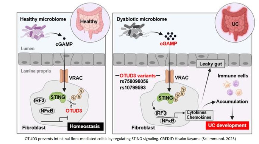 A deubiquitinase prevents ulcerative colitis by inhibiting microbiota-mediated STINF activation