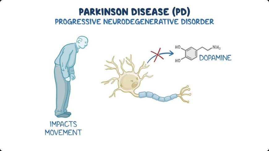 PARKINSON’S DISEASE