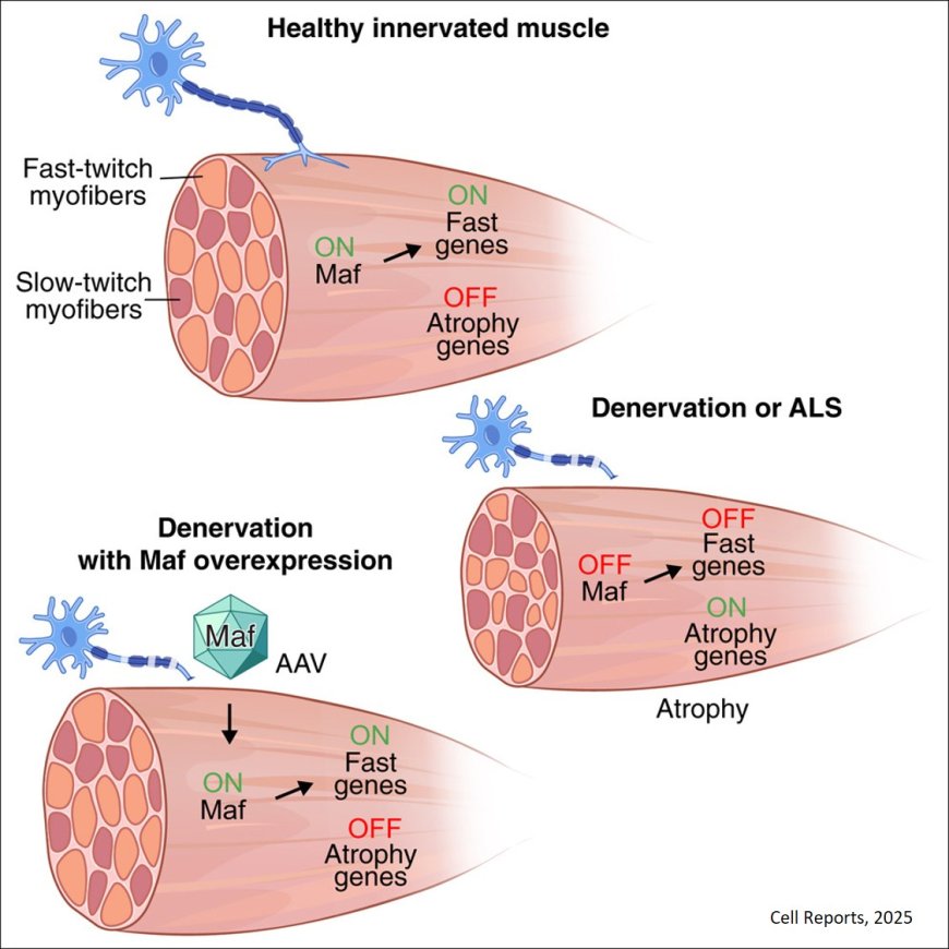 A mechanistic basis of fast myofiber vulnerability to neuromuscular diseases