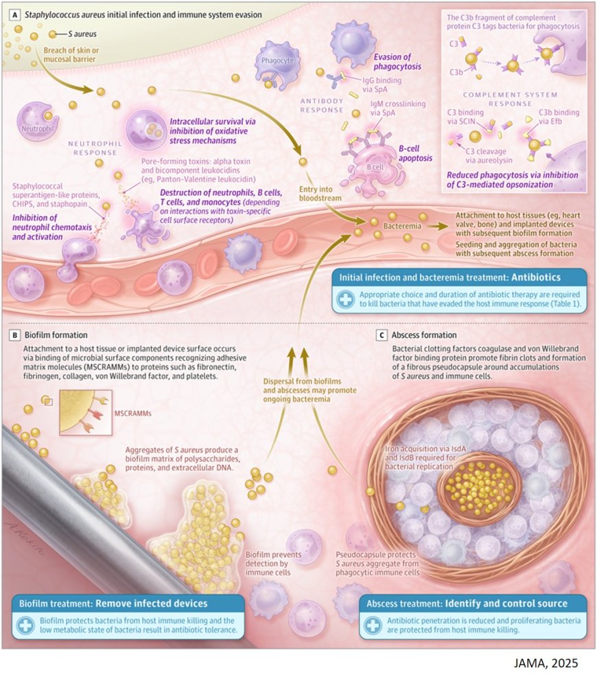 Management of Staphylococcus aureus Bacteremia
