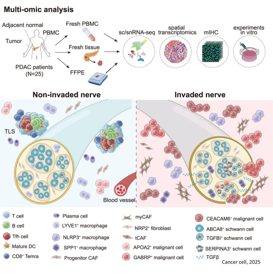 Integrated single-cell and spatial transcriptomics uncover distinct cellular subtypes involved in neural invasion in pancreatic cancer