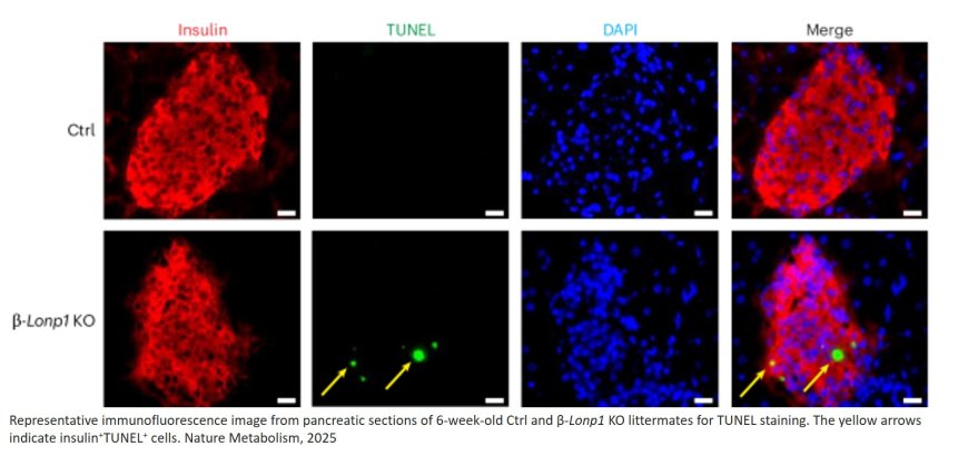 LONP1 regulation of mitochondrial protein folding provides insight into beta cell failure in type 2 diabetes