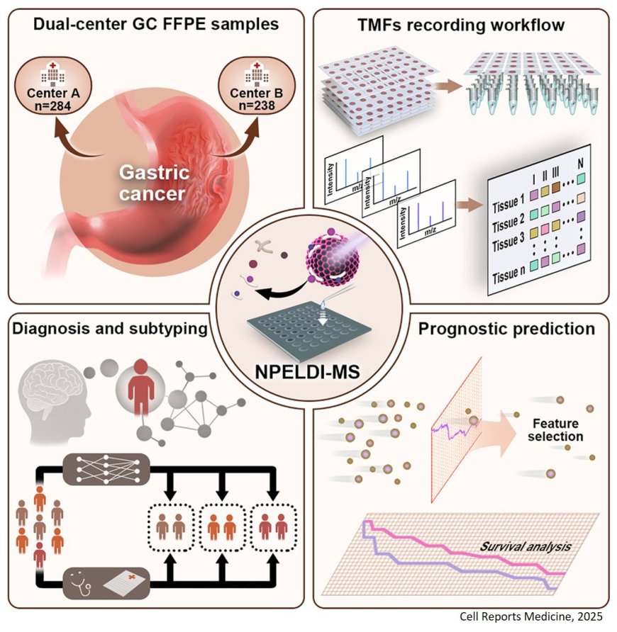 Label-free histopathology in gastric cancer diagnosis