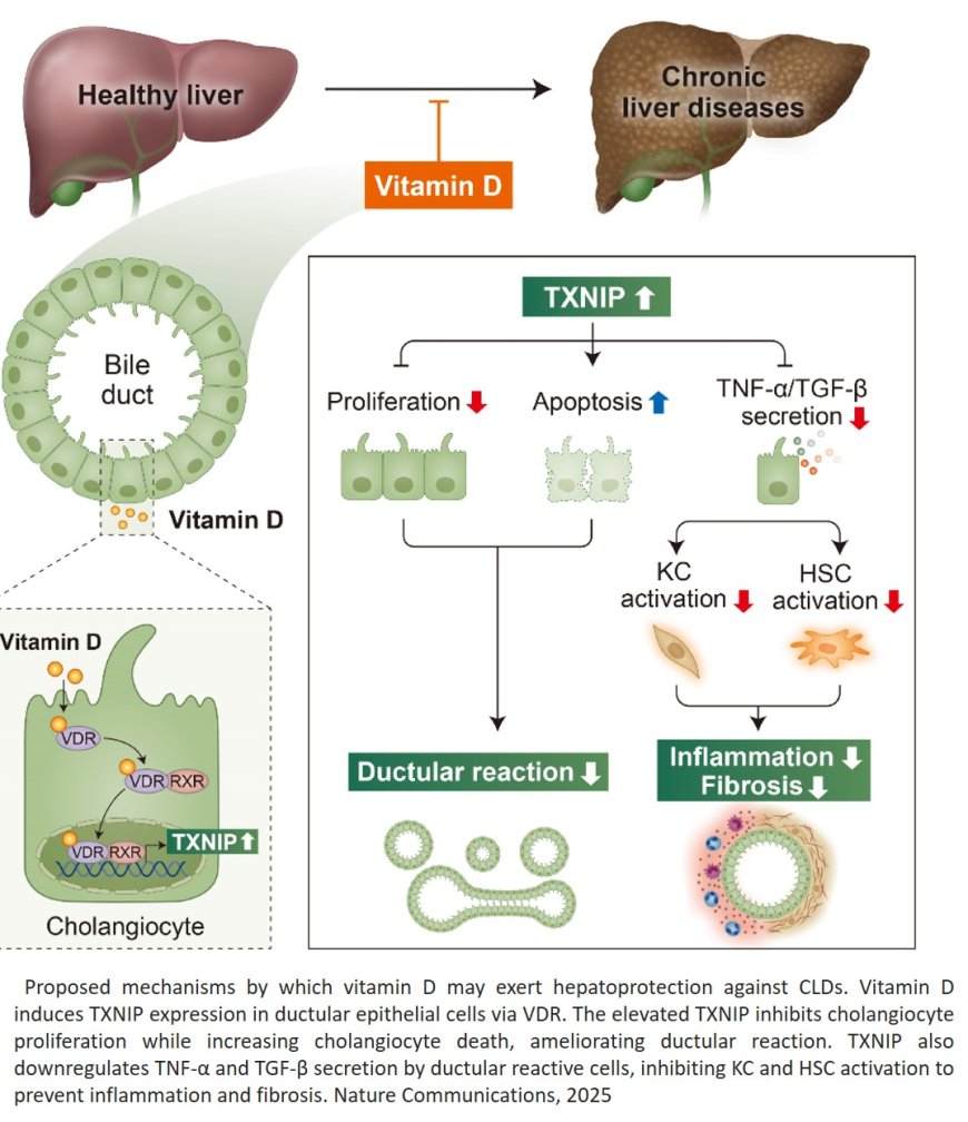 Vitamin D supplementation ameliorates ductular reaction, liver inflammation and fibrosis in mice by upregulating TXNIP in ductular cells