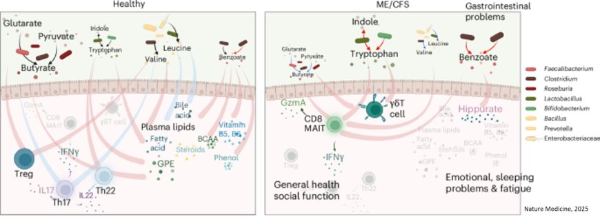 Gut microbiome may predict “invisible” chronic fatigue syndrome and long COVID