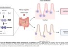 Cysteinyl leukotrienes stimulate gut absorption of food allergens to promote anaphylaxis