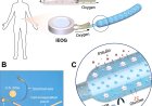Implant treats Type 1 diabetes by oxygenating insulin-producing cells