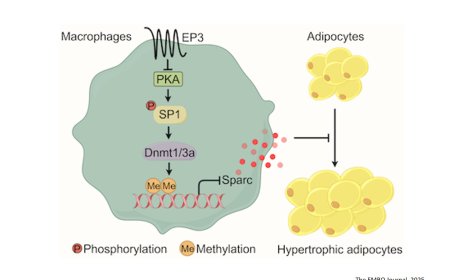 How macrophages aggravate diet-induced obesity